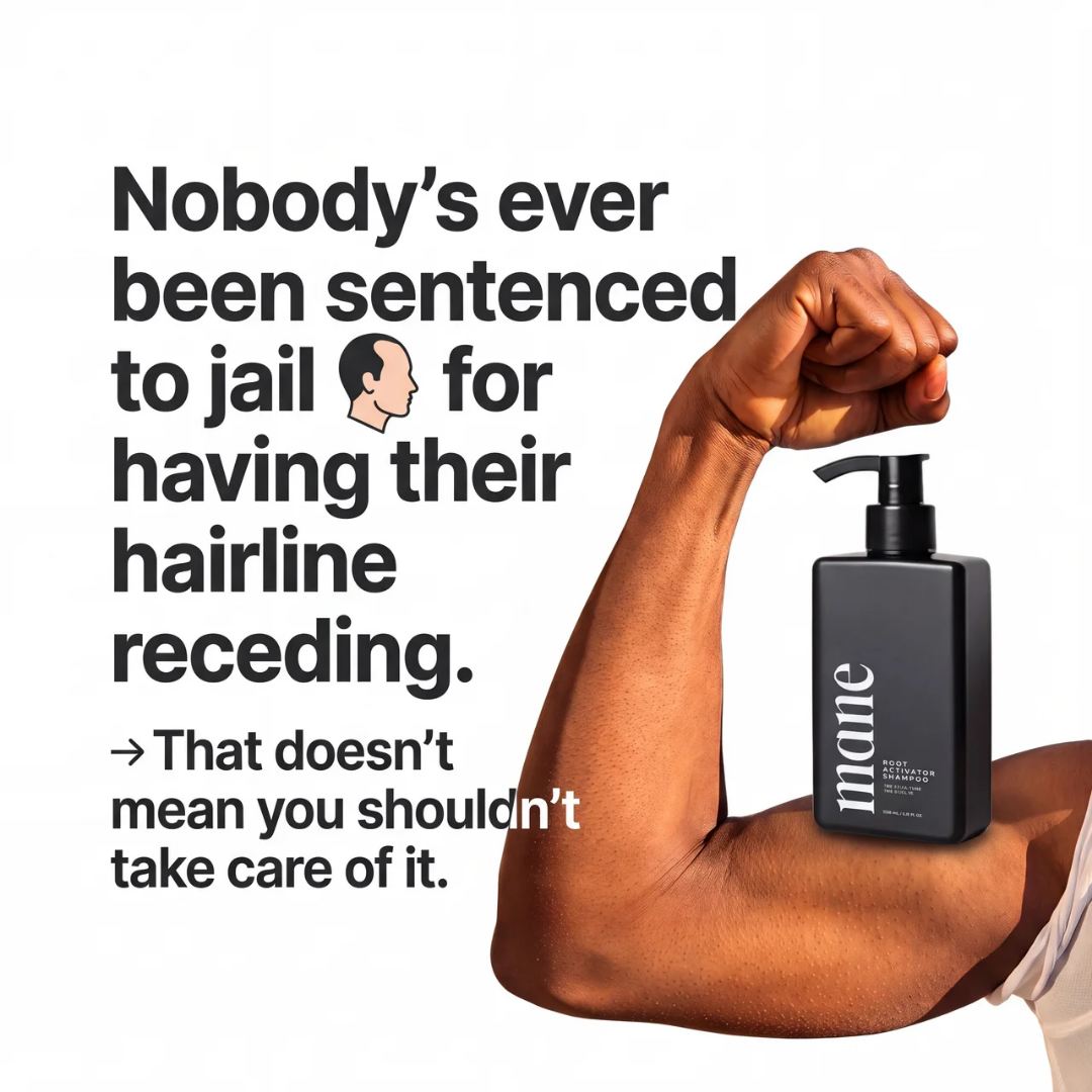 Mane ad — nobody's ever been sentenced to jail for a receding hairline
